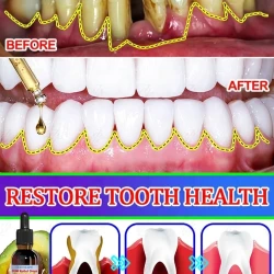 Gum Care Drops Intensive Oral Health Serum