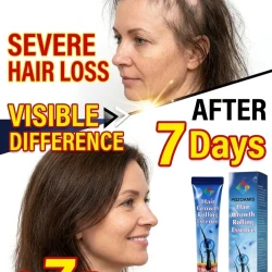 Nourishing Scalp Massaging Roll-on Essence Serum